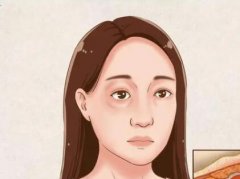 嗨体除皱眼部效果好不好？更多科普知识等你查询