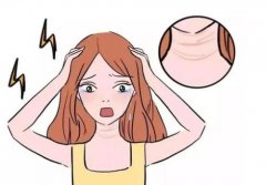 激光除皱大概多少钱一次？讲解好处与坏处分别是什么？