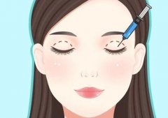 男生双眼皮手术要多少钱？探讨风险、恢复阶段