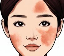 超皮秒祛斑的危害与效果会反弹吗？几天能看到结果
